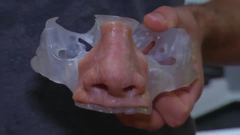 3D tool predicts nose jobs much more accurately