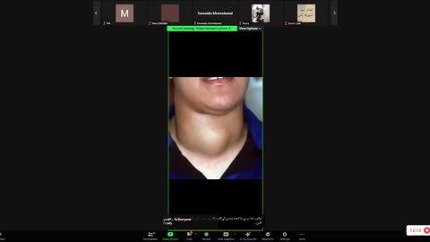 ST5.38 year old man with neck swelling.mp4