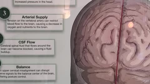 The Atlas-Upper Cervical Chiropractic