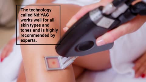 The Laser Hair Removal Guide for Dark Skin