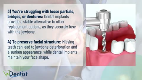 Top Reasons to Consider a Dental Implant for Tooth Replacement
