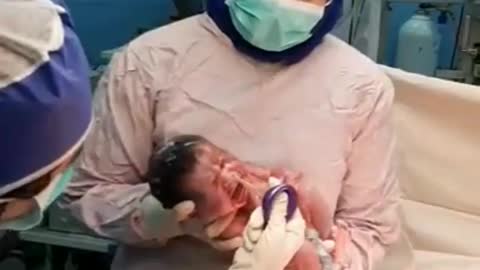 Cesarean section in shomal hospital