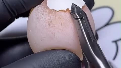 Removing Egg Shell