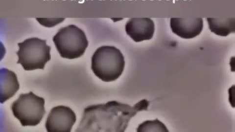 (through a microscope )A human white blood cell.chasing a bacterium.Must watch