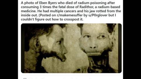 The Man Who Drank So Much Radiation He Became Radioactive & Had to be Buried in a Lead Lined Coffin