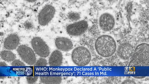 Maryland has 71 monkeypox cases amid global health emergency