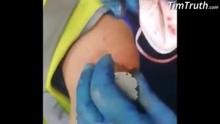 small N52 Neodymium magnet sticks to arm after second vaccine