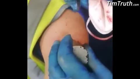 small N52 Neodymium magnet sticks to arm after second vaccine