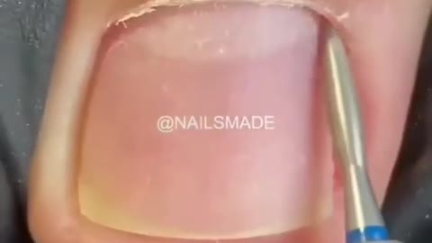 most satisfying pedicure transformation #shorts #pedicure #nails