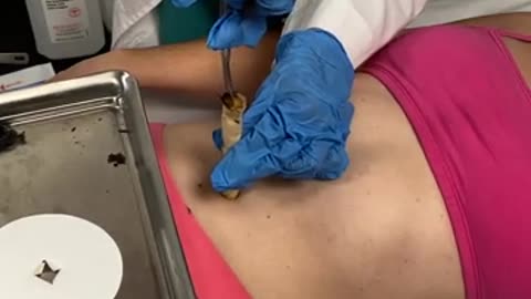so CRAZY what came out of her BELLY BUTTON! 😱