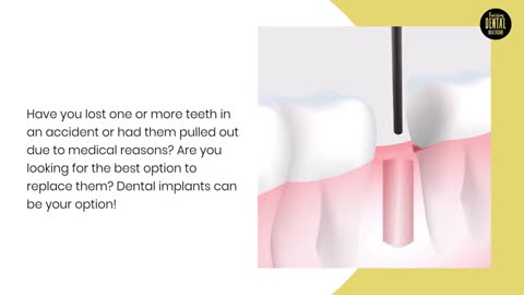 Discover the Unique Benefits of Dental Implants