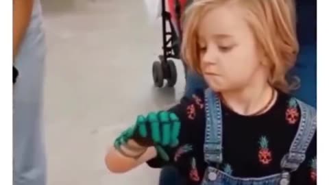 Little Girl Given Modern Prosthetic Hand