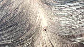 Removing a Tick From a Client's Head