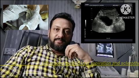 Ultrasound guided cyst aspiration.