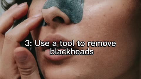 Tips to remove blackheads #trending #blackheads