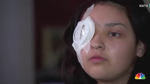 California Fast Food Worker To Lose Eye After Customer Attack