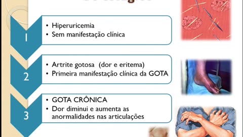 Farmacoterapia Gota (07/06/23)