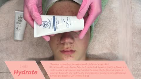 Acne Clarifying Facial + HD Pimple Popping {Super Informative} Jadeywadey180