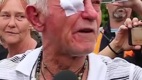 80-yr-old man pepper-sprayed by police in Australia