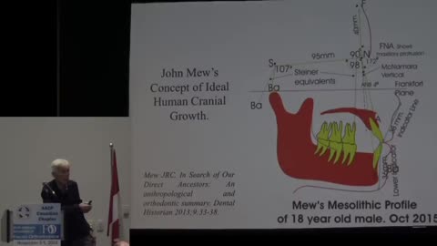 How Best To Achieve Forward Facial Growth By Prof John Mew. Vancouver | November 2016