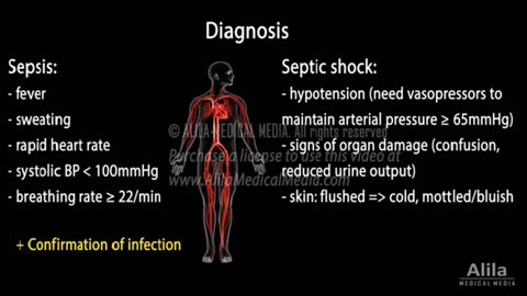 Understanding Sepsis and Septic Shock through Animation