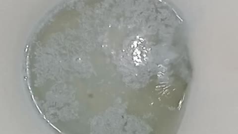 A whirlpool toilet