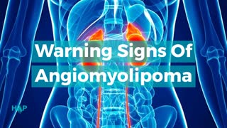 Warning Signs Of Angiomyolipoma