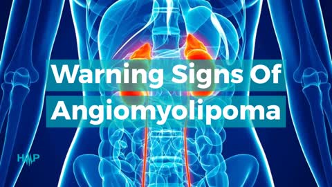 Warning Signs Of Angiomyolipoma