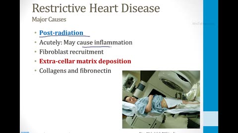 Cardiology - 6. Heart Failure - 3.Restrictive Cardiomyopathy