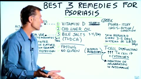 Psoriasis Treatment-The Best 3 Remedies for Psoriasis