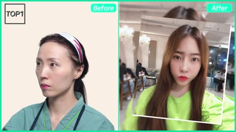 THE BEST BEFORE & AFTER RESULTS OF PLASTIC SURGERY KOREA | FANTASTIC TRANSFORMATION MAKEOVER