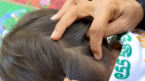 Remove all hundred lice from hair - Get out head lice from short hair