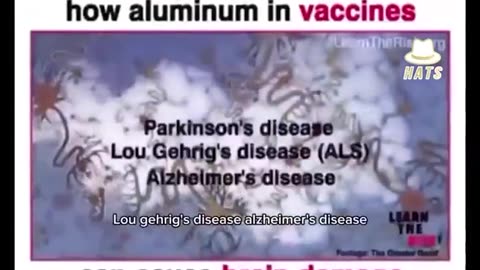 Aluminum In Vaccines - The Facts