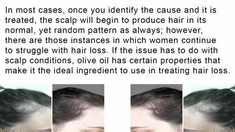 Get Rid of Hair Loss Naturally/ Extra Virgin Olive Oil For Hair Loss Treatment |