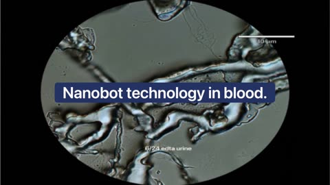 Graphene Oxide, a Magnetic Body, Microplastics and Nanobot Technology