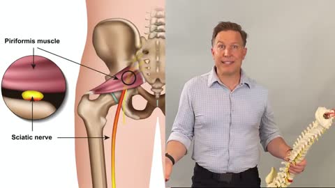 Simple Solutions to Sacroiliac (SI) Joint Pain