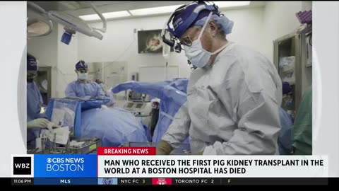 MAN WHO RECEIVED FIRST EVER GENETICALLY ENGINEERED PIG KIDNEY TRANSPLANT DIED AFTER TWO MONTHS.