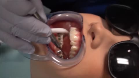 HOW ARE BRACES PUT ON? COME WITH ME TO START MY ADULT BRACES JOURNEY