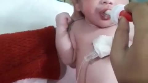 Premature Baby - Nutrition and feeding । Preemie Baby New born । Miracle Baby