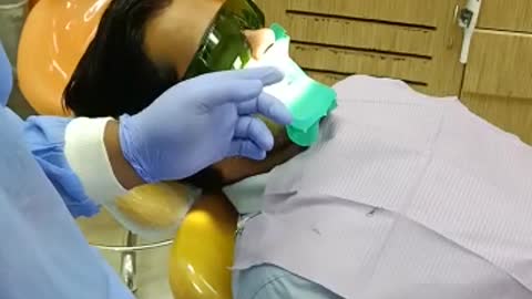 Laser root canal