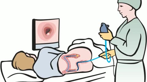 DIY COLONOSCOPY! (from Feb 2016)