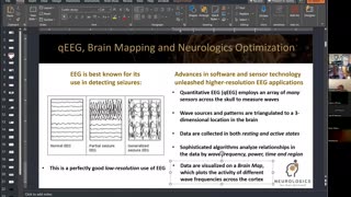 101. Neurologics to Rewire Your Cognitive Brain Networks