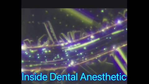 Inside Dental Anesthetic... Are you going to the dentist anytime soon?