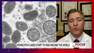 Dr. Jonathan Baugh Breaks Down Monkeypox -- "In Focus"