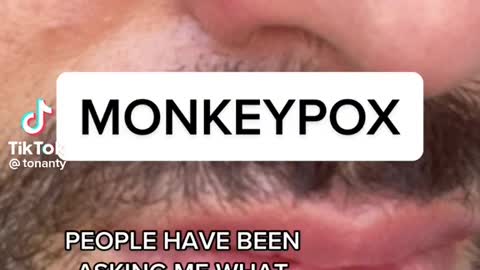 Monkeypox