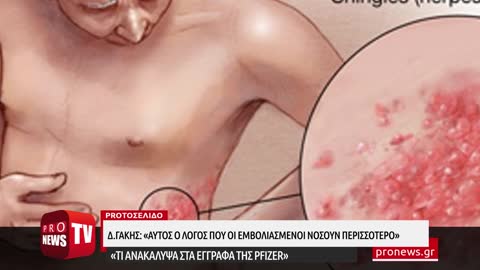 Γάκης στο pronews.gr:«Αυτός είναι ο λόγος που οι εμβολιασμένοι νοσούν περισσότερο»