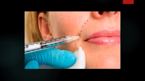 Best Anti Wrinkle Injectables in Ashmore