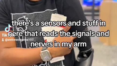 Full Robotic Arm With An Ai chip That Reads Sensor Signals From The Nerves