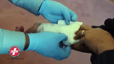 First Aid: Severe Bleeding