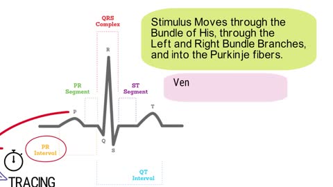 What is an Electrocardiogram? (EKG/ECG) *SIMPLE Explanation*